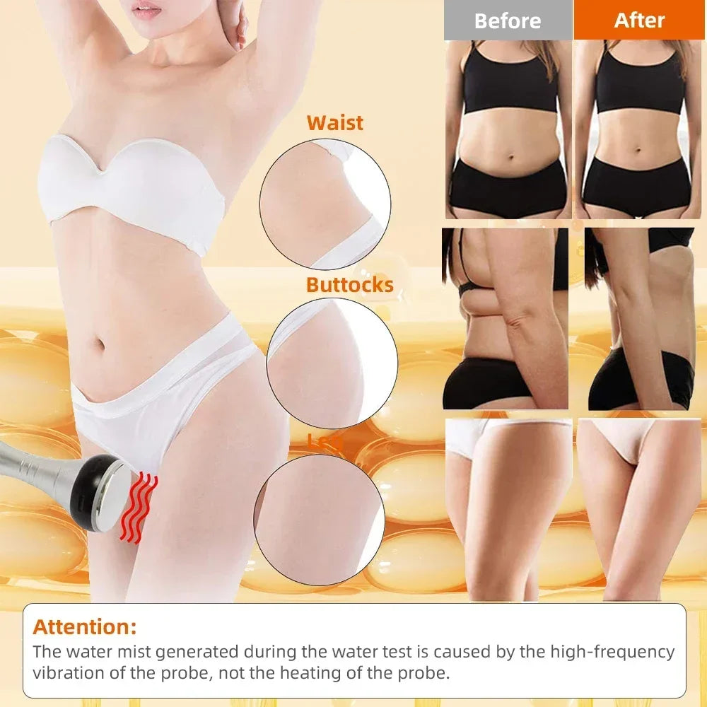 Missheart 4In1 Cavitation Body Slimming Machine Vacuum Massager