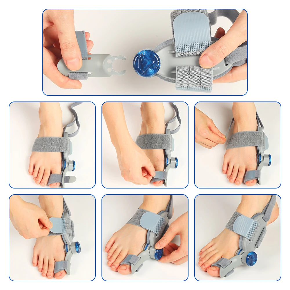 Moajaza Adjustable Bunion Toe Straightener With Silicone Pad